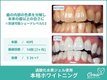 クレア(Crea)/【ホワイトニング症例写真】