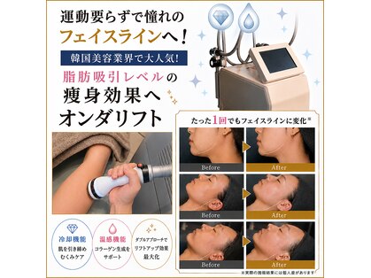 ピナリ(PINARI)の写真