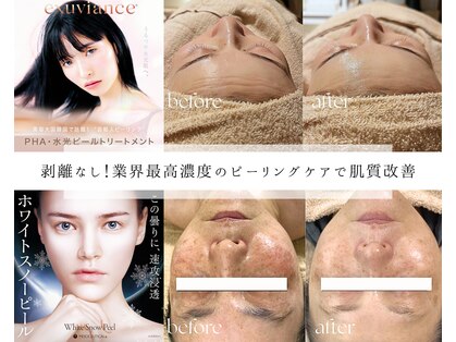 ソアム(Soame)の写真