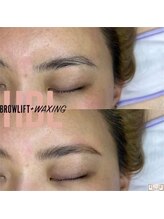 エリス(ELISSE)/ハリウッドブロウリフト