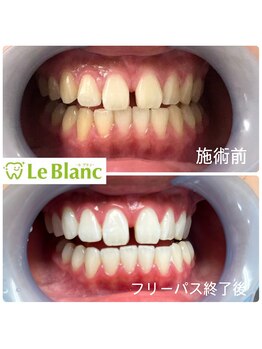 ルブラン 奈良店(Le Blanc)/驚きの違い！