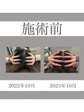 キクキク(KIKUKIKU)/1年のBeforeAfter