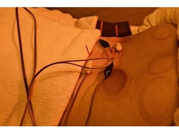 デルタエヌピー63+(δnp63+)/カッピング【小顔/薬院/福岡】