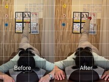 ナオル整体 札幌院(NAORU整体)/円山公園/西２８丁目/骨盤矯正