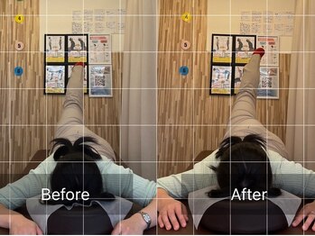 ナオル整体 札幌院(NAORU整体)/円山公園/西28丁目/骨盤矯正