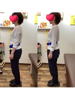 ヒデ整体院(Hide整体院)/腰痛　反り腰改善　姿勢骨盤矯正