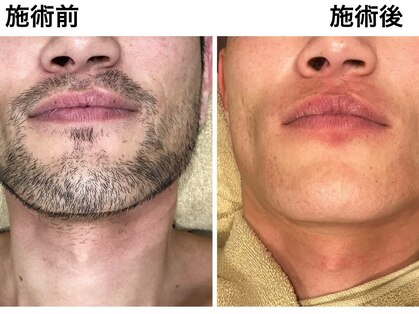 ルシェリ(Lecheri)の写真