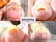 サロンドットプディング(Salon.Pudding)の写真/【巻き爪補正の特許技術認定サロン◎】長年の悩みを解消！効果実感！月1回、最短3ヵ月で完了！１か所¥6600