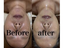 小顔 ツヤ肌/毛穴、くすみの無い肌へ