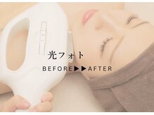 アンドエピ(&epi)/