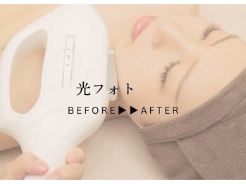 アンドエピ(&epi)/