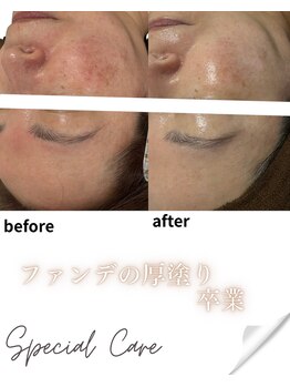 リノン(LIINON)/ファンデの厚塗り卒業