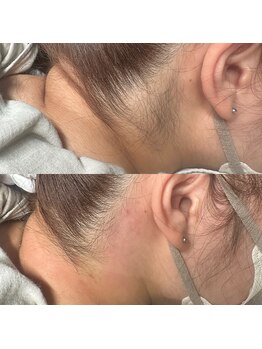 トトノウダケデ/うなじWAX