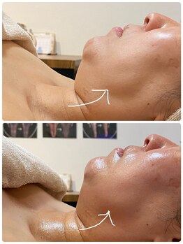 オージャス(OJAS)/40代/ 【小顔フェイシャル】