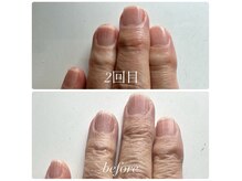 ベルティフィー(belltiffy)の雰囲気（自爪育成&ハンドエステ症例【爪の縦筋を改善したい】）