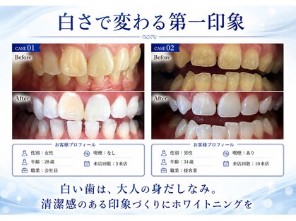 ホワイトニングショップ 霧島店の写真