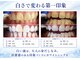 ホワイトニングショップ 霧島店の写真