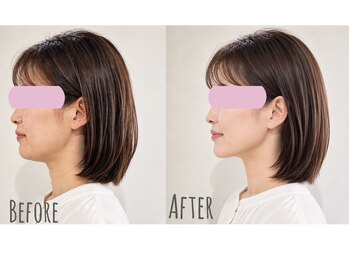 ルア バイ ビューティ 四条烏丸(RUA by beauty)の写真/【NEWOPEN記念】速攻小顔集中☆首肩ケア付￥6600♪熟練ハンド×マシンでその日に効果を実感*《四条烏丸》