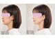 ルア バイ ビューティ 四条烏丸(RUA by beauty)の写真/【NEWOPEN記念】速攻小顔集中☆首肩ケア付￥6600♪熟練ハンド×マシンでその日に効果を実感*《四条烏丸》