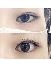 abp /ラッシュリフト