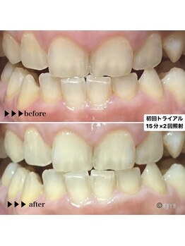 ビーバイビー(BBYB)/お客様ビフォーアフター☆