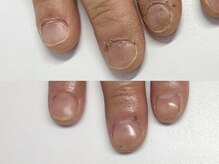 キラネイル アンド アイラッシュ by World Beauty(KIRA)/新潟自爪育成　