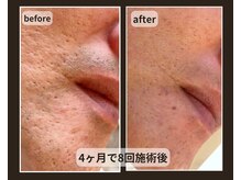 スパロウ(RF sparrow)/５０歳　男性