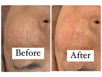 サロンドフェイス 木曽川店(Salon de Faith)/毛穴・たるみ・しみケア♪