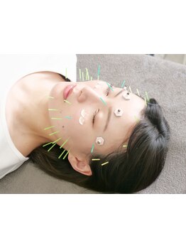 鍼灸施術を受けたい