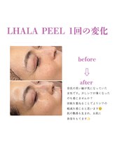 ベル(BELL)/シワやシミが気になる方へ