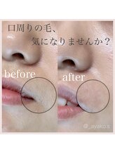 スイ 金山駅前(sui)/口周りワックス