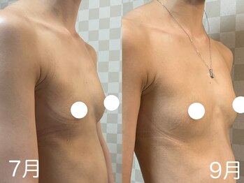 ハレオラ(HaleOla)/30代　ブラとクリームで♪♪♪