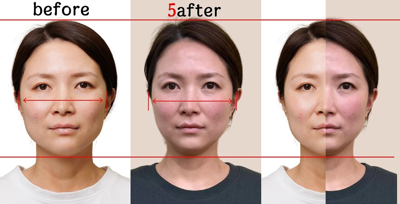 C045234209.jpg?h=178&impolicy=