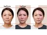 初回限定 【顔が更にギュッと引き締まる◎】 小顔矯正＋顔リンパ循環改善