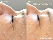 ルチア 博多店(Lucia)/韓国肌管理"ララピール"