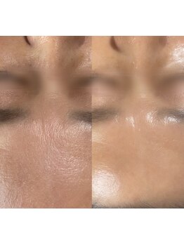 ハリツヤをUPしたい