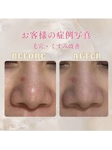 パンジー 上野フェイシャルエステ専門店(pansy)/*フェイシャル/毛穴ケア*