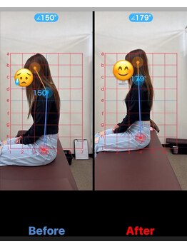 美田園5丁目接骨院/全身骨格矯正before⇒after