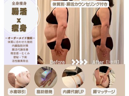 ルノン(Lunon)の写真