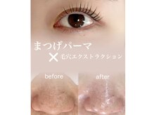 アモア(amoa)の雰囲気（忙しい日々の中で“美＋癒しの時間”を大切にしていますか？）