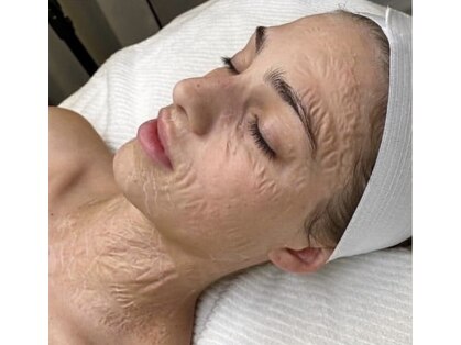 サロンドエピレーション トパーズ(Salon d’ epilation TOPARDS)の写真