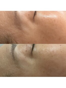 アミュレット(amulette)/目元もふっくら♪