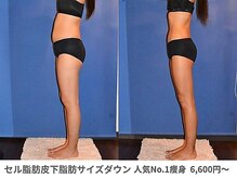 ピュアノア 垂水店/痩身ダイエット　神戸垂水明石