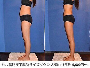 ピュアノア 垂水店/痩身ダイエット 神戸垂水明石