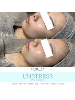 フルアナ(Hu ruana)/フェイシャルエステ