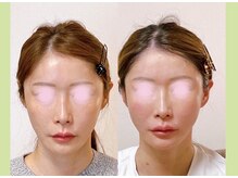 顔のコンプレックスを解消★中顔面や面長に圧倒的に強いサロン!!