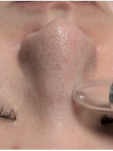 ビアンカーラ(Biancara)