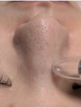 ビアンカーラ(Biancara)の写真/長野県内でも希少!話題の毛穴ケア【韓国式3D毛穴洗浄】施術後は化粧ノリの違いを実感◎