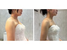 ティースタイル(T-Style)/ブライダル before/after