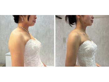 ティースタイル(T-Style)/ブライダル before/after